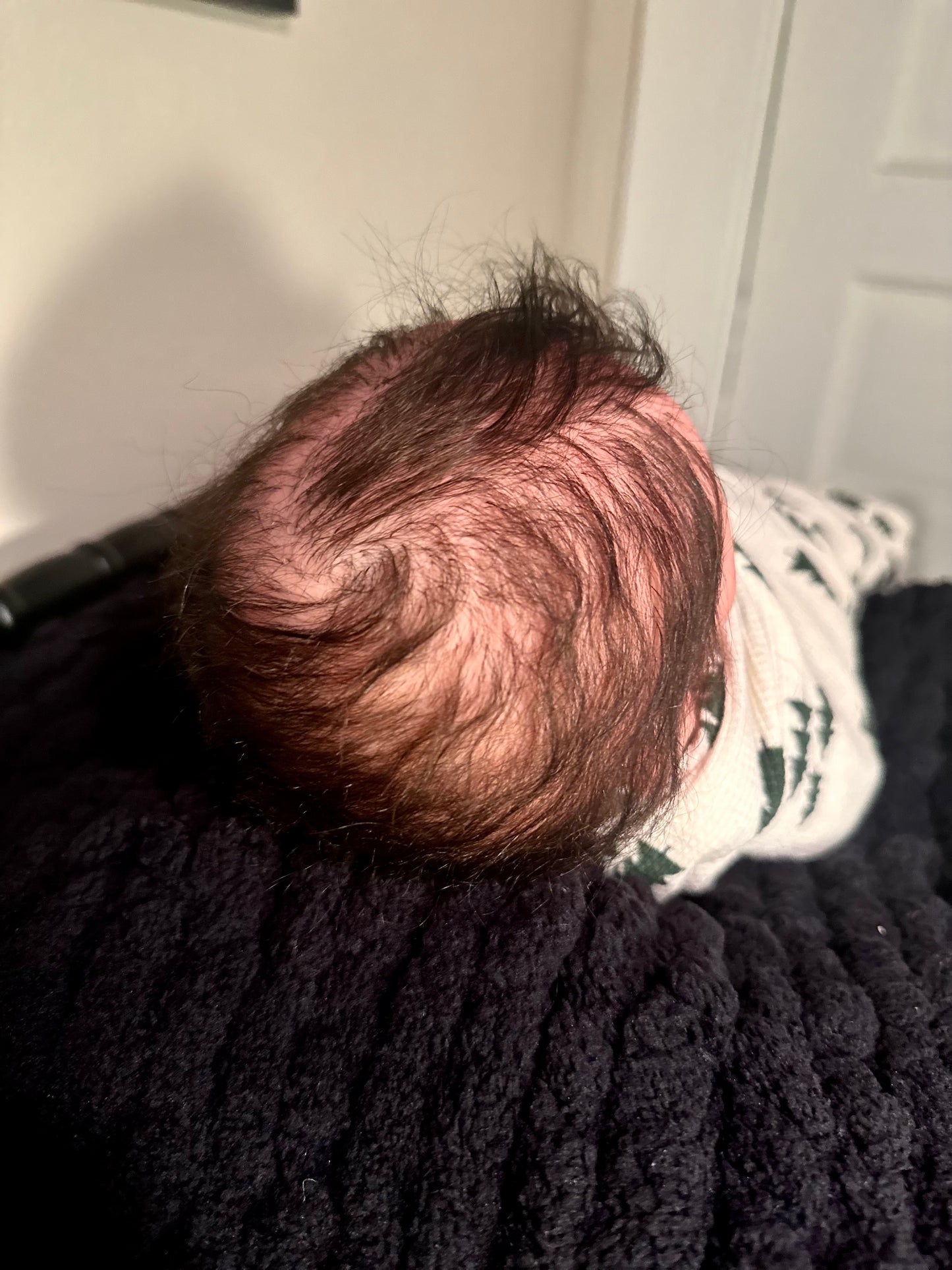 Hair Rooting Services